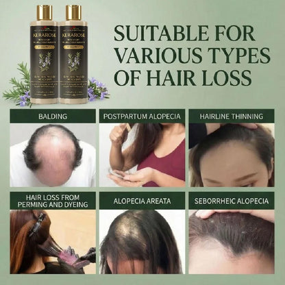 Kerarose Rosemary Hydrolyzed Keratin Shampoo 114 gm (Pack of 2)